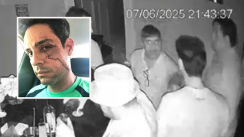 Ministério Público denuncia agressor que quebrou copo de vidro no rosto de empresário; vítima levou 62 pontos