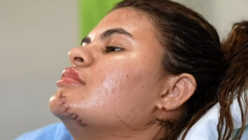 'Estava consciente o tempo todo', diz Ana Clara sobre tentativa de feminicídio em que teve mãos decepadas pelo cunhado