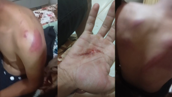Família denuncia que policiais torturaram jovem com faca, marteladas e saco na cabeça no Ceará