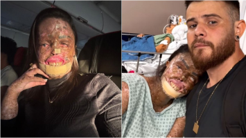 Quem era Káh Felipe, influencer cearense diagnosticada com doença rara que morreu após metástase