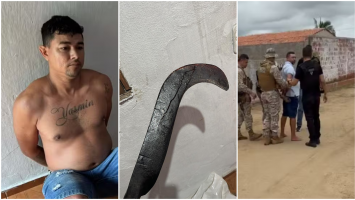 Jovem tem as mãos reimplantadas após namorado amputá-las com foice, diz delegado