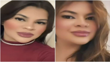 Cirurgia que reimplantou mão de jovem amputada pelo namorado durou 12 horas e foi bem-sucedida